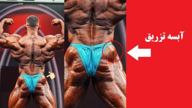 درمان آبسه تزریق عضلانی؛ علت، علائم، تخلیه آبسه و پیشگیری